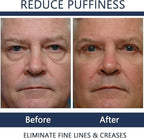 Men Eye Cream Anti Aging