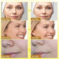 Botox Bee Venom Cream