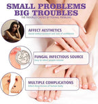 Nail Fungus Spray