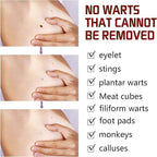 tags and moles remover